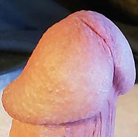 Big mushroom dick head