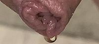 Pissing through foreskin closeup 2