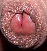 close up of my pee/cum hole and foreskin