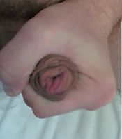 Foreskin pic...:S