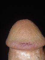 Cock Head