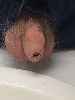 Foreskin and hairy balls