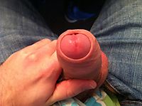 great foreskin i just got done playing with