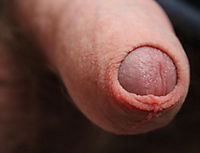 Soft cock with close view of foreskin